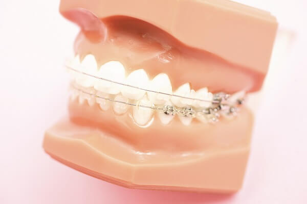 何歳でも歯が健康であれば矯正治療は可能です